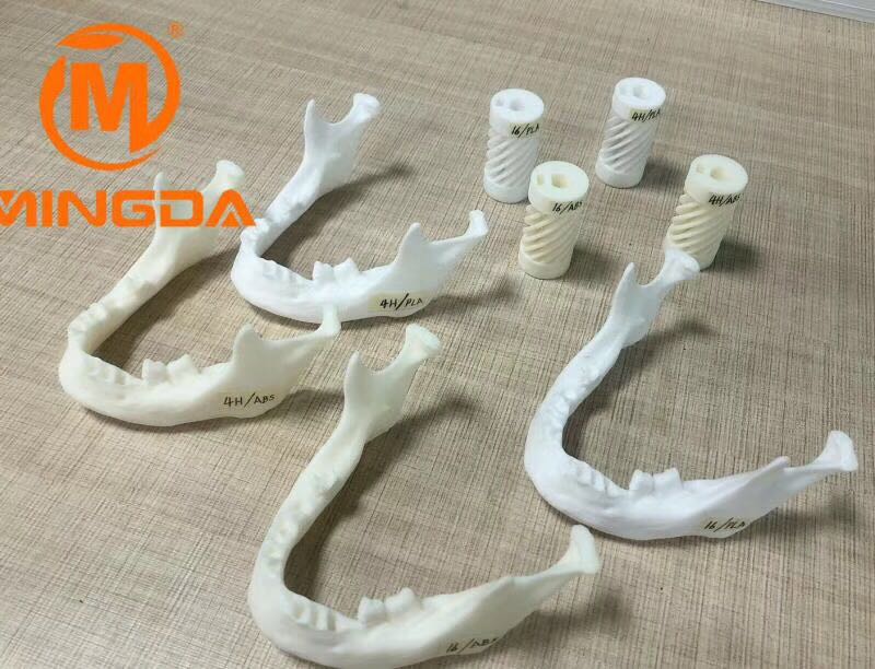 工業(yè)級3D打印機在牙科行業(yè)的應(yīng)用(圖1)